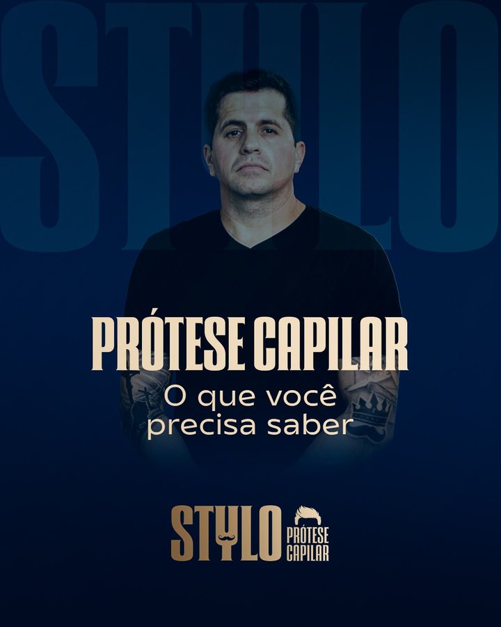 Prótese capilar: o que você precisa saber